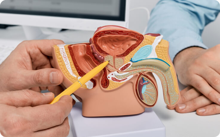Kegunaan Prosterafit untuk Kesehatan prostat Pria