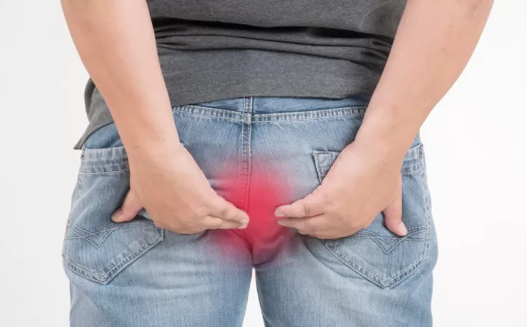 hemotera-Apakah Wasir Bisa Sembuh Sendiri