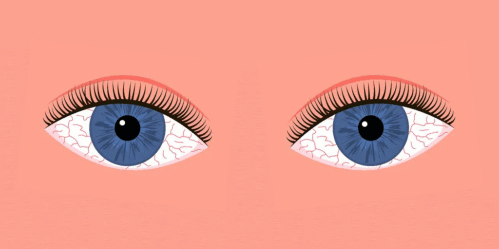 ometa-Rekomendasi Obat Mata Merah Alami yang Aman dan Efektif