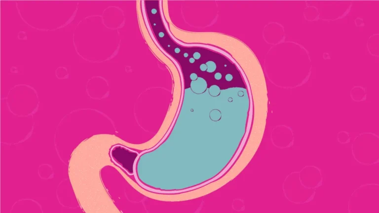 soluma-Jangan Biarkan Asam Lambung Tinggi Mengganggu, Lakukan Ini