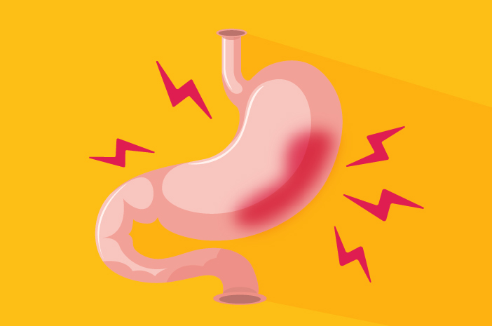 soluma-Penyebab Lambung Bocor yang Sering Terjadi