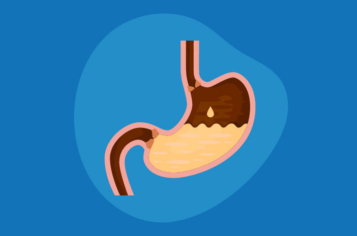 soluma Perbedaan Sakit Maag dan Lambung, Jangan Sampai Salah Menangani!