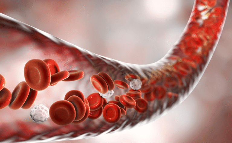 yochanna - Penyakit Albumin Itu Apa Kenali Gangguan Saat Kadar Albumin Menurun