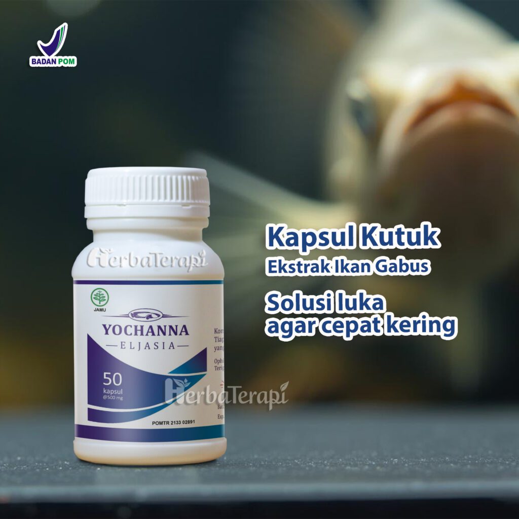 yochanna kapsul kutuk terbaik